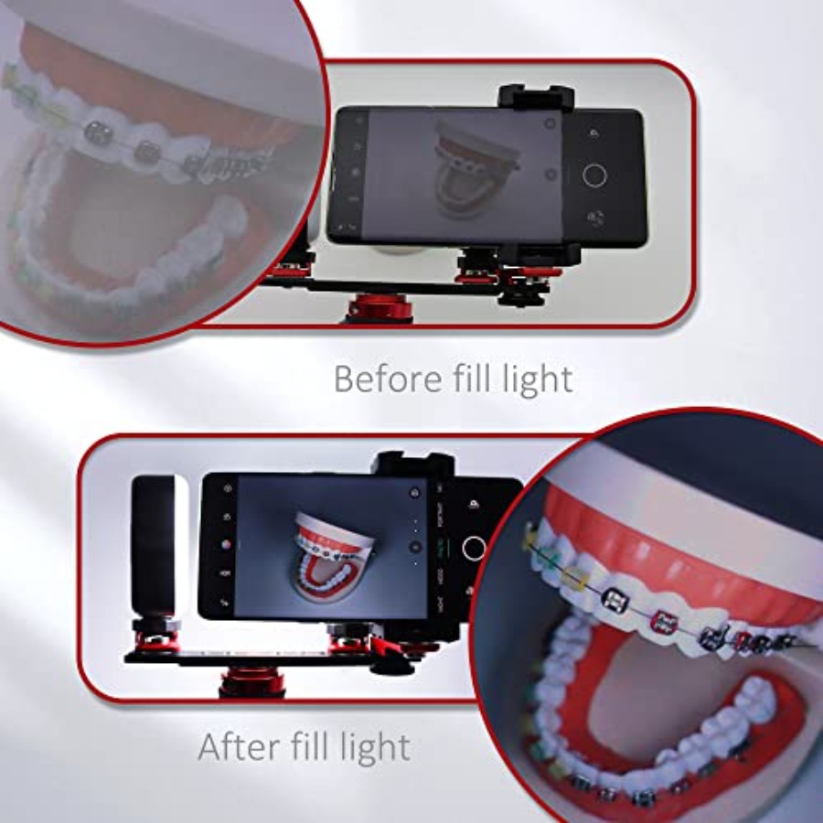 Bluetooth Dental Flash Light P - Photography Lighting With Flash avis et prix