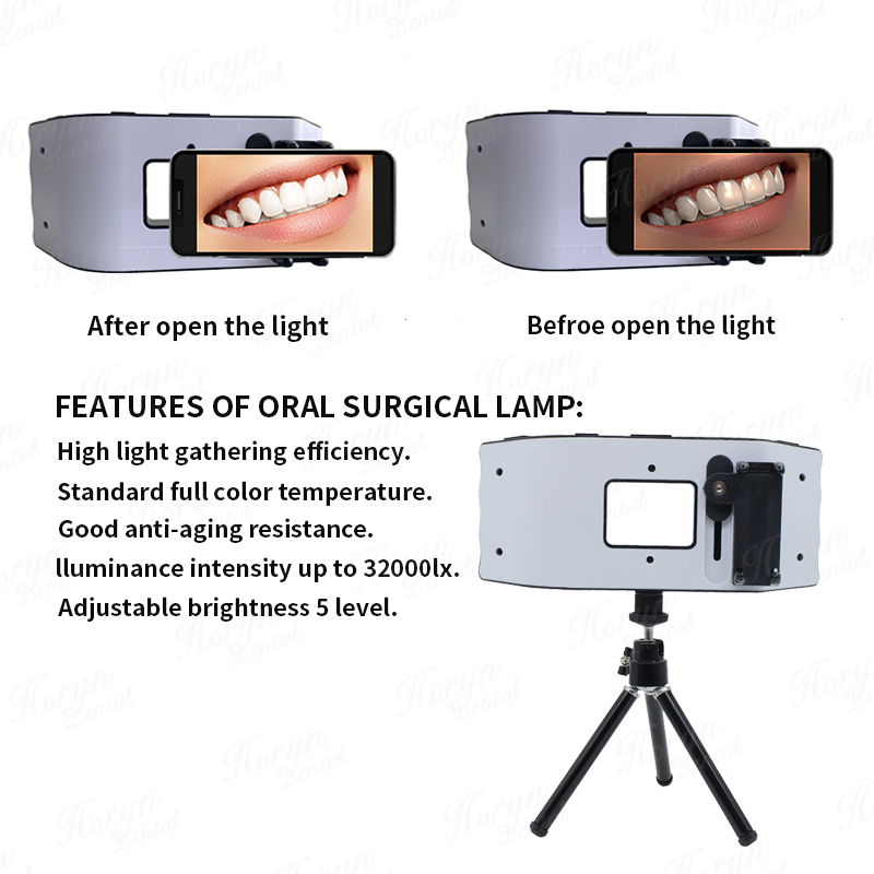 Dental Flash Light Photography - Photography Lighting With Flash avis et prix